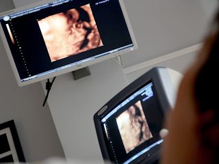 Badania USG w ciąży.
